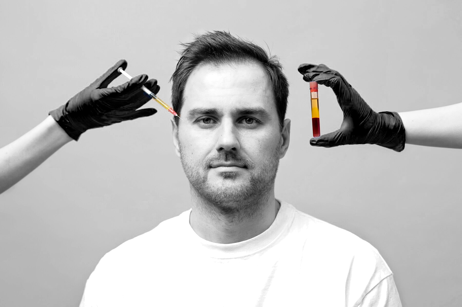 Hair Loss Treatment Solutions